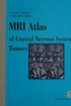 MRI Atlas of Central Nervous System Tumors