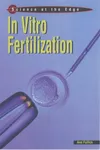 In vitro fertilization