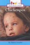 Chickenpox