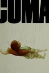 Coma