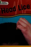 Head lice