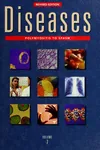 Diseases