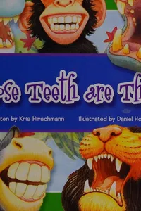 Whose teeth are these?