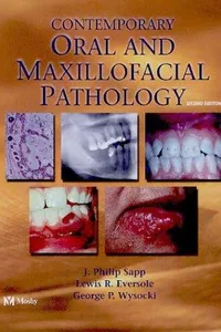 Contemporary oral and maxillofacial pathology