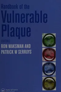 Handbook of the vulnerable plaque