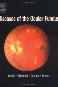 Diseases of the ocular fundus