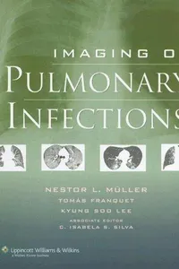 Imaging of pulmonary infections