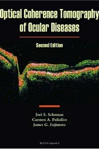 Optical coherence tomography of ocular diseases