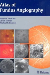Atlas of fundus angiography