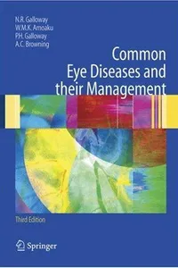 Common Eye Diseases and their Management
