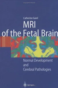 MR imaging of the fetal brain