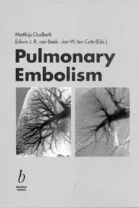 Pulmonary embolism