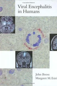 Viral encephalitis in humans