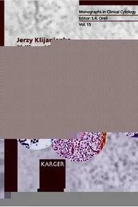 Salivary Gland Tumors