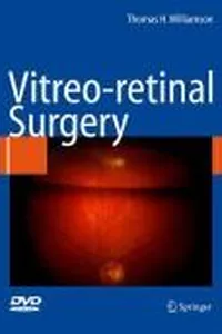 Vitreoretinal surgery