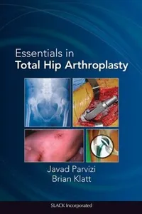 Essentials In Total Hip Arthroplasty