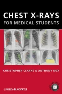 Chest Xrays For Medical Students