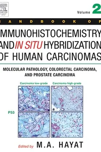 Handbook of Immunohistochemistry and in Situ Hybridization of Human Carcinomas