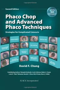 Phaco Chop and Advanced Phaco Techniques