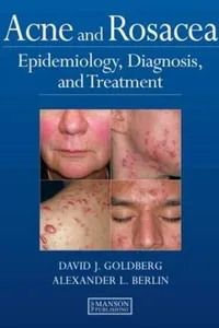 Acne and Rosacea
