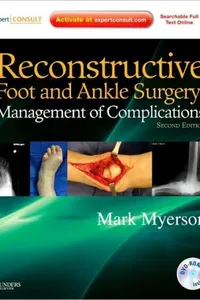Reconstructive foot and ankle surgery