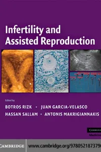 Infertility and assisted reproduction