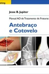 Manual AO de Tratamento de Fraturas