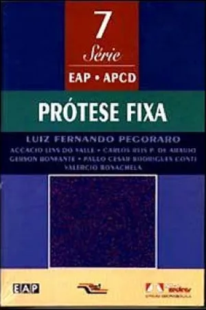 Prótese Fixa