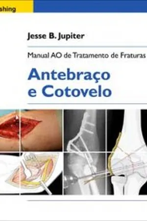 Manual AO de Tratamento de Fraturas