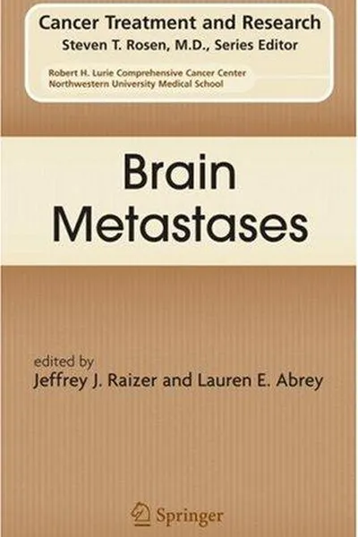 Capa de Brain metastases