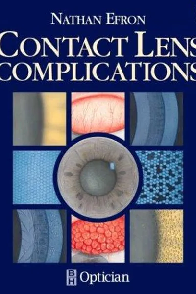 Capa de Contact lens complications