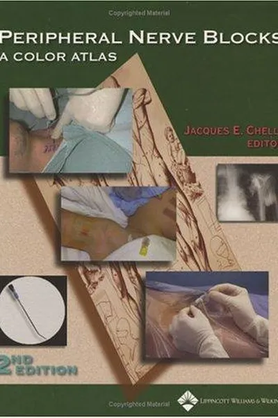 Capa de Peripheral Nerve Blocks