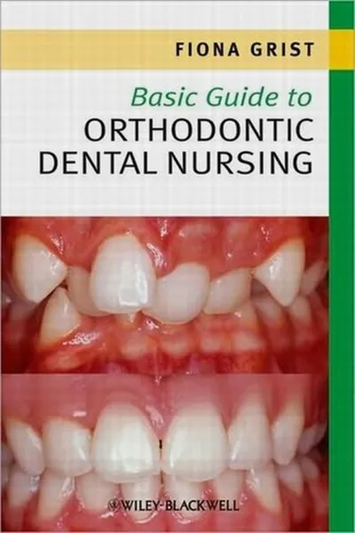Capa de Basic guide to orthodontic dental nursing