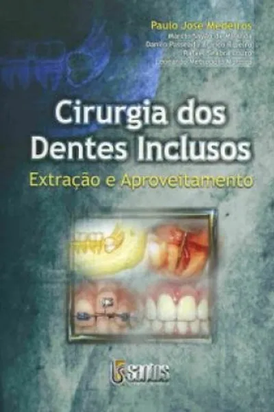 Cover of Cirurgia dos Dentes Inclusos