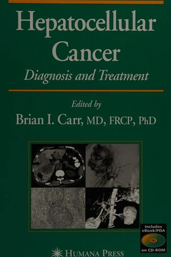 Capa de Hepatocellular cancer