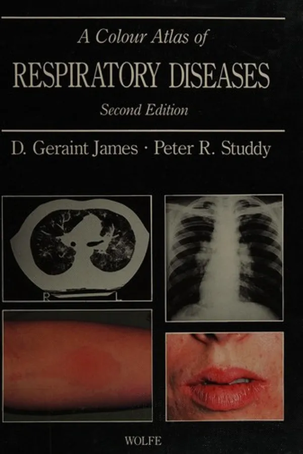 Capa de A colour atlas of respiratory diseases