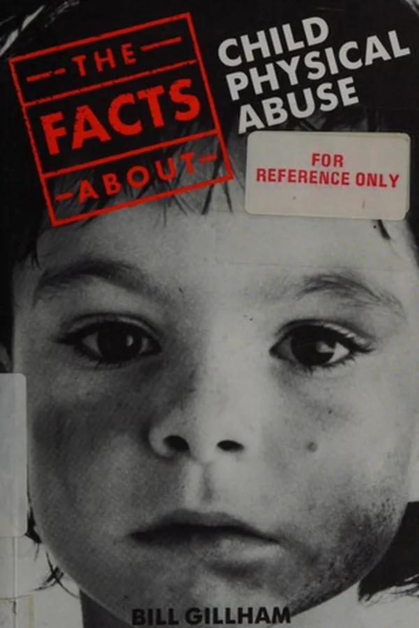 Capa de The Facts About Child Physical Abuse (The Facts About Series)