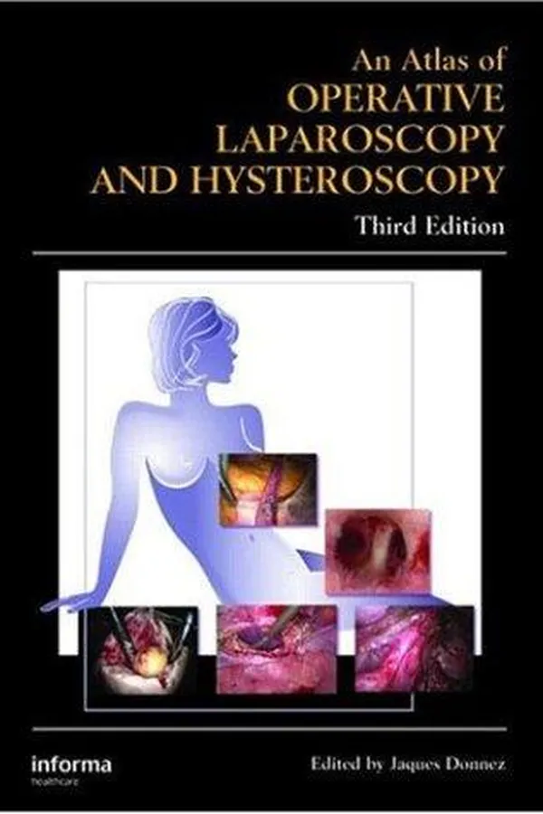 Capa de Atlas of Operative Laparoscopy and Hysteroscopy, Third Edition (Encyclopedia of Visual Medicine)