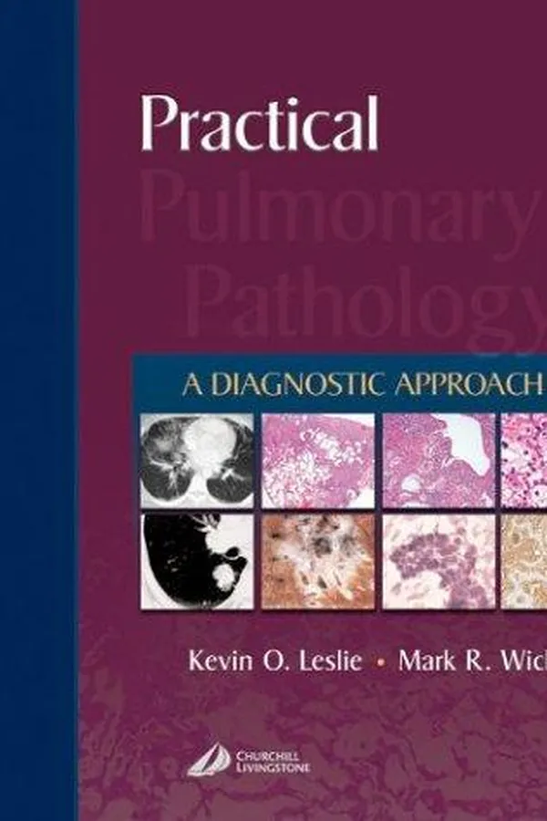 Capa de Practical pulmonary pathology
