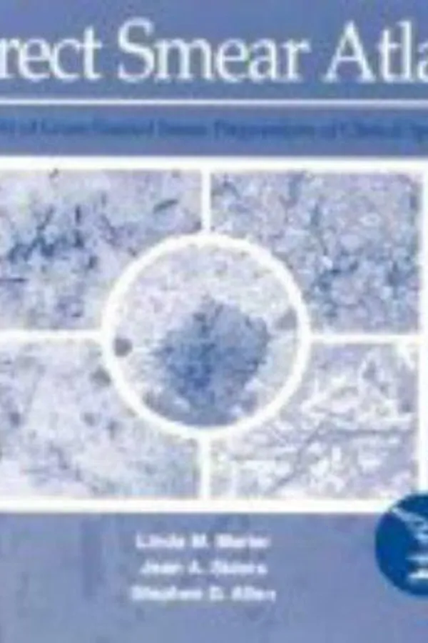 Cover of Direct Smear Cd