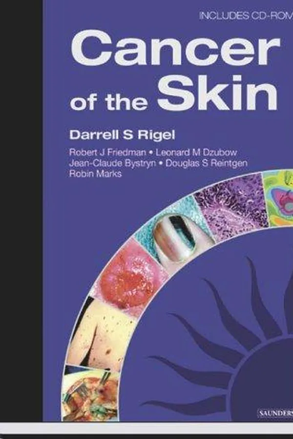 Capa de Cancer of the skin