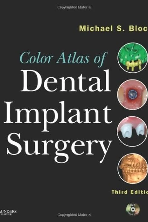 Capa de Color atlas of dental implant surgery