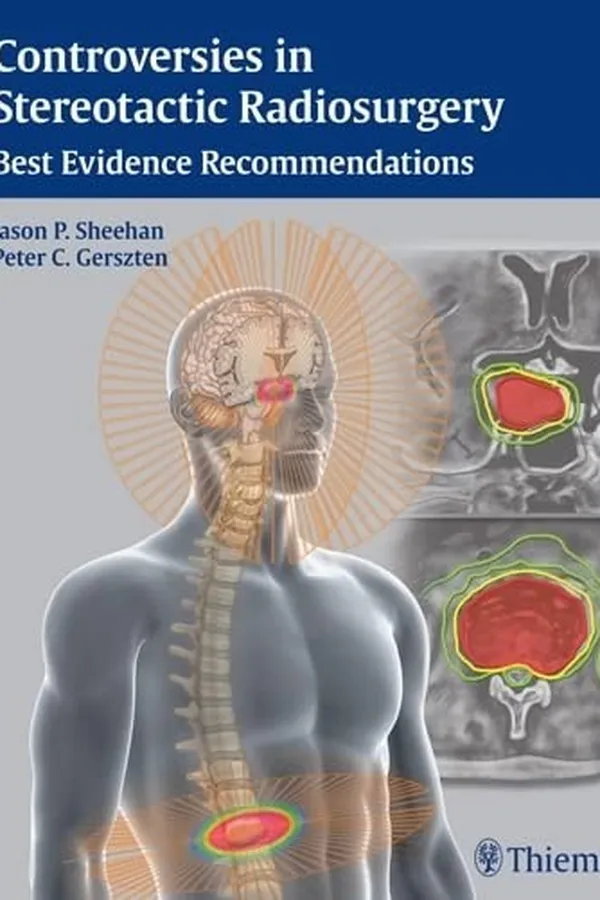 Capa de Sellar and parasellar tumors