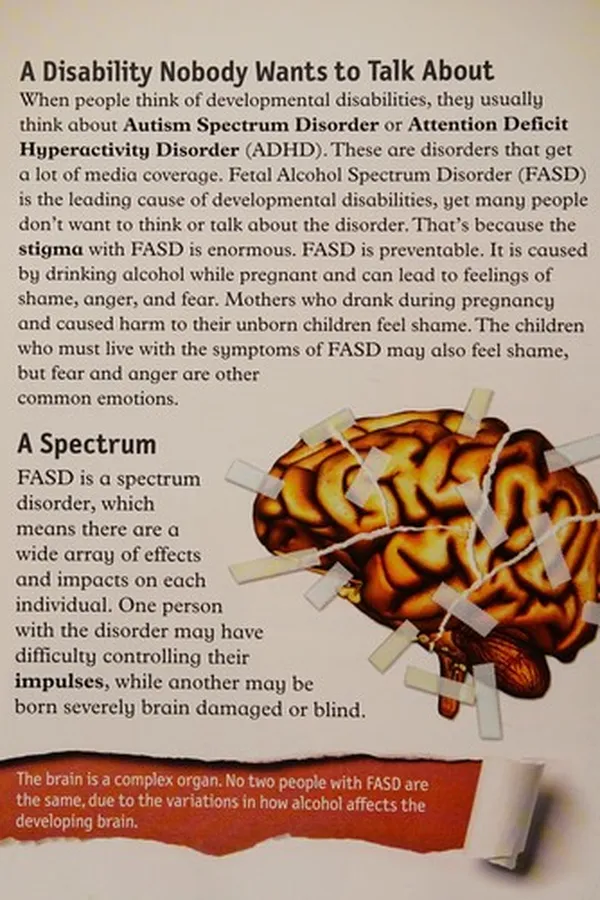 Capa de Fetal alcohol spectrum disorder