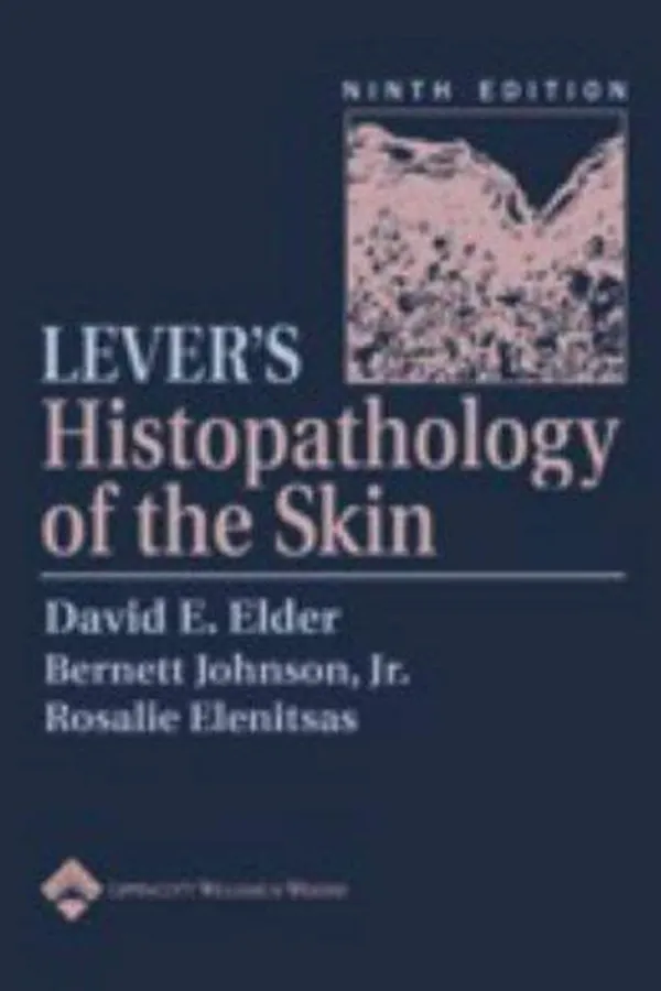 Capa de Lever's Histopathology of the Skin