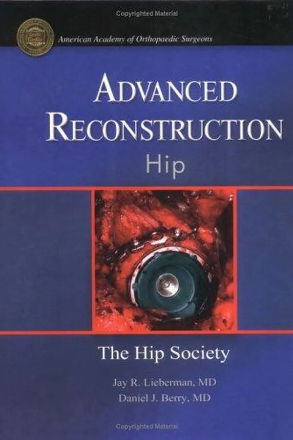 Capa de Advanced reconstruction hip
