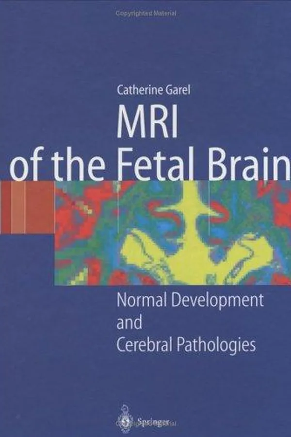 Capa de MR imaging of the fetal brain