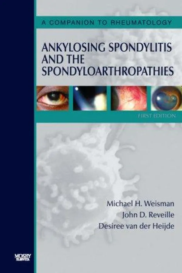 Capa de Ankylosing spondylitis and the spondyloarthropathies