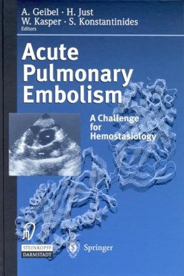 Capa de Acute pulmonary embolism