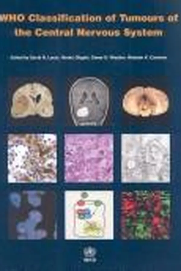 Capa de WHO classification of tumours of the central nervous system